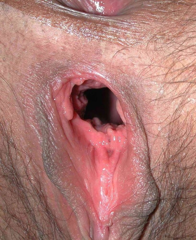 Frauenvagina in der Nähe -up