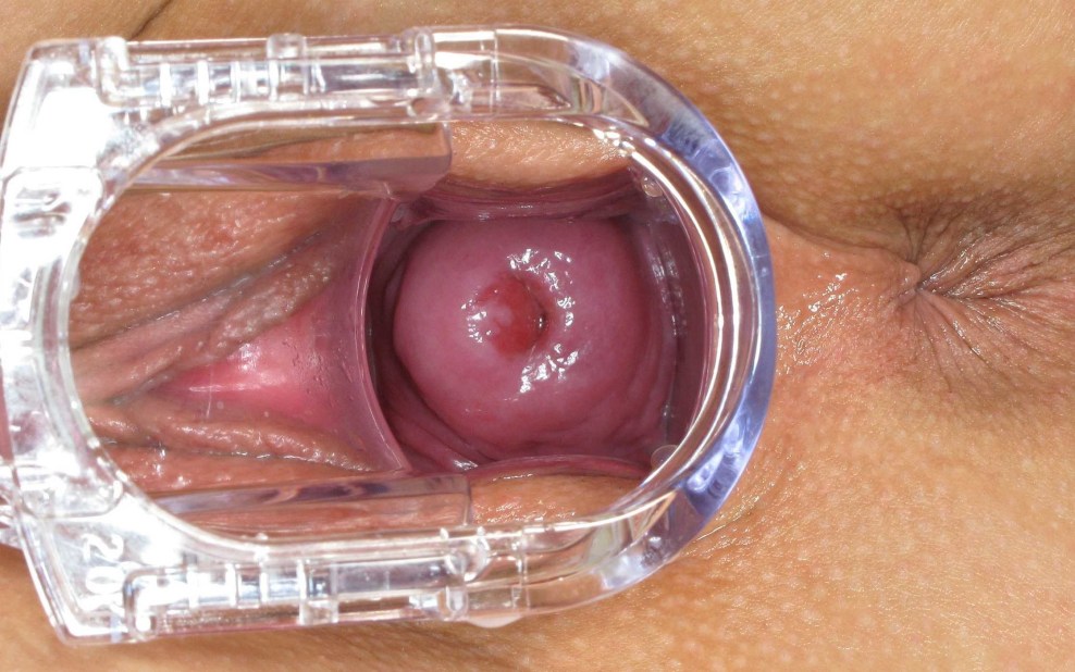 Frauenvagina im Inneren