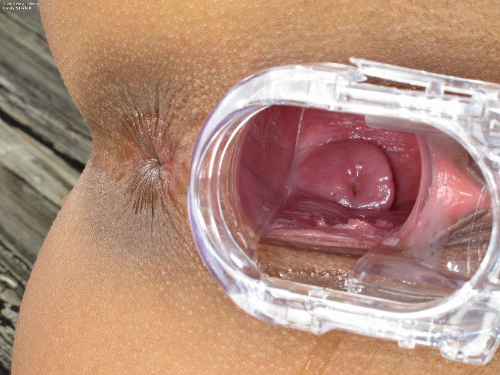 Gesunde Vagina von innen