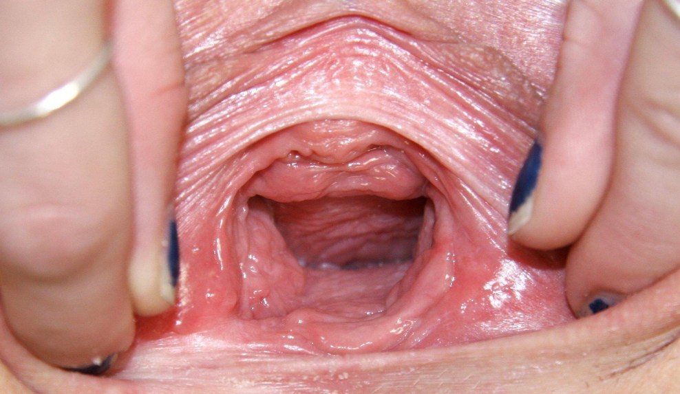 Vagina und Gebärmutter von innen