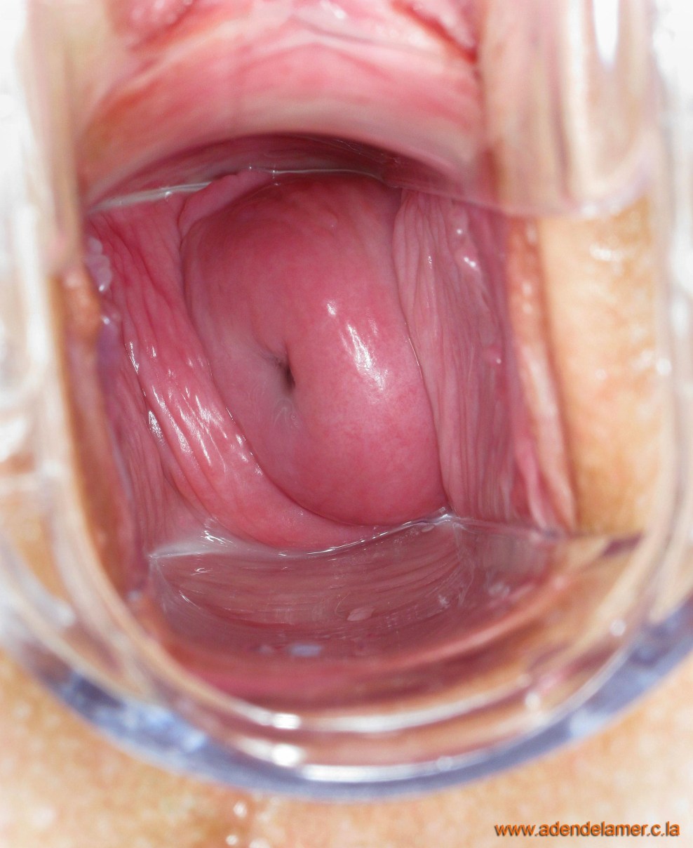 Gesunde Vagina von innen