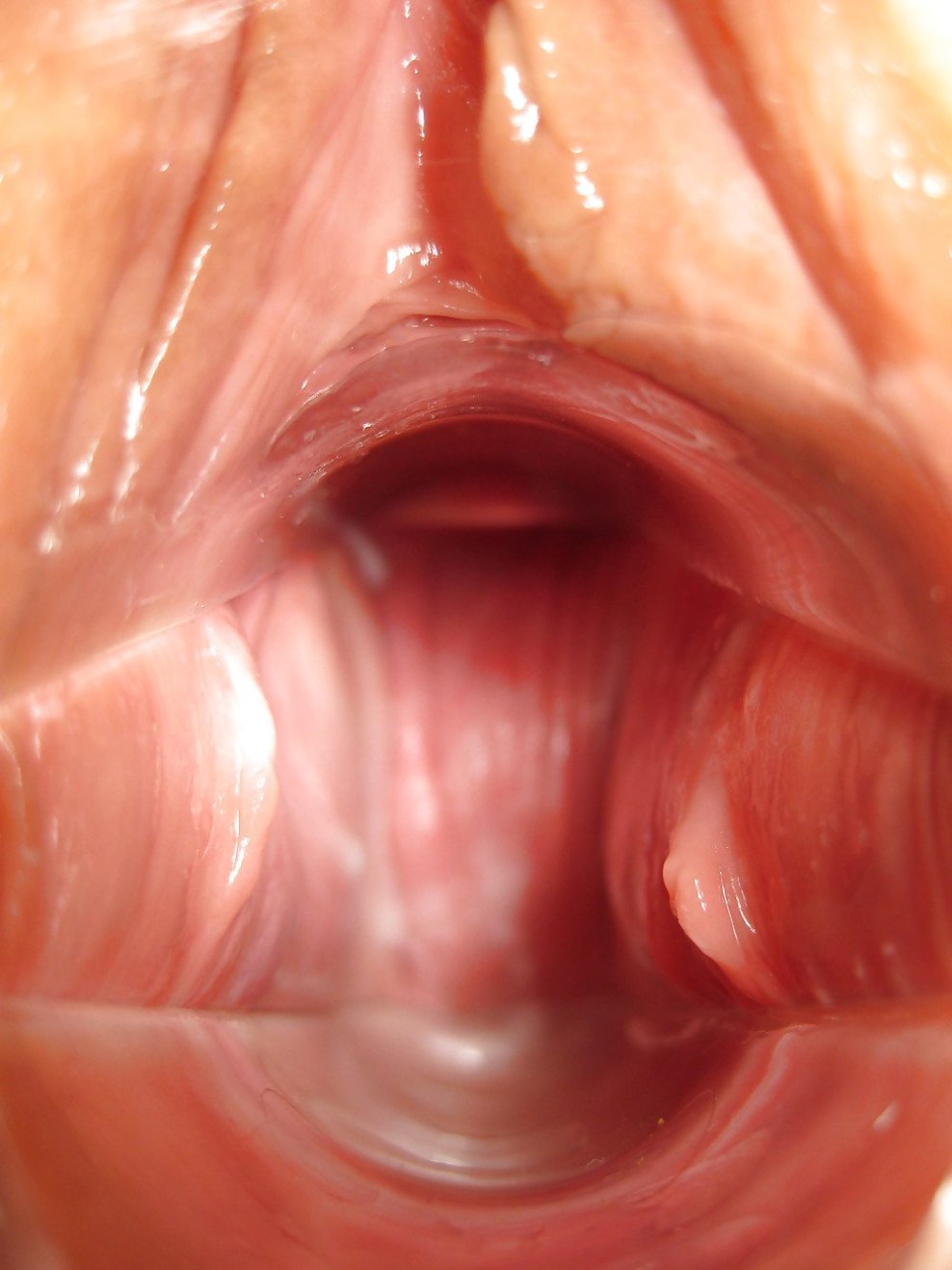 Die Struktur der Vagina von innen