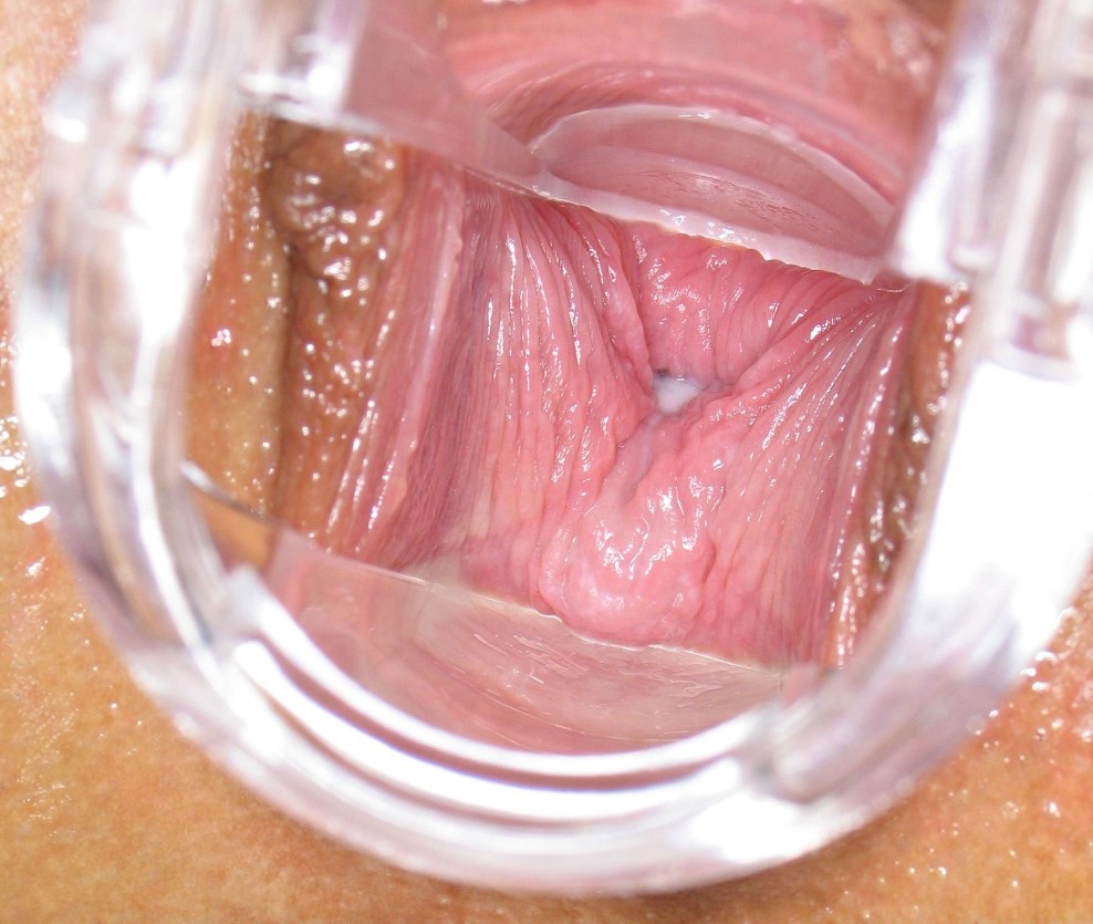 In der Vagina schießen